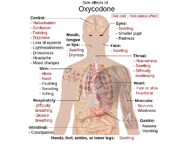 Side Effects of Oxycodone